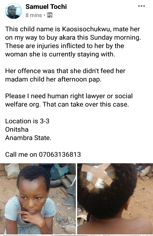 Lady inflicts heavy injury on maid for allegedly failing to feed her child (Graphic Photos)