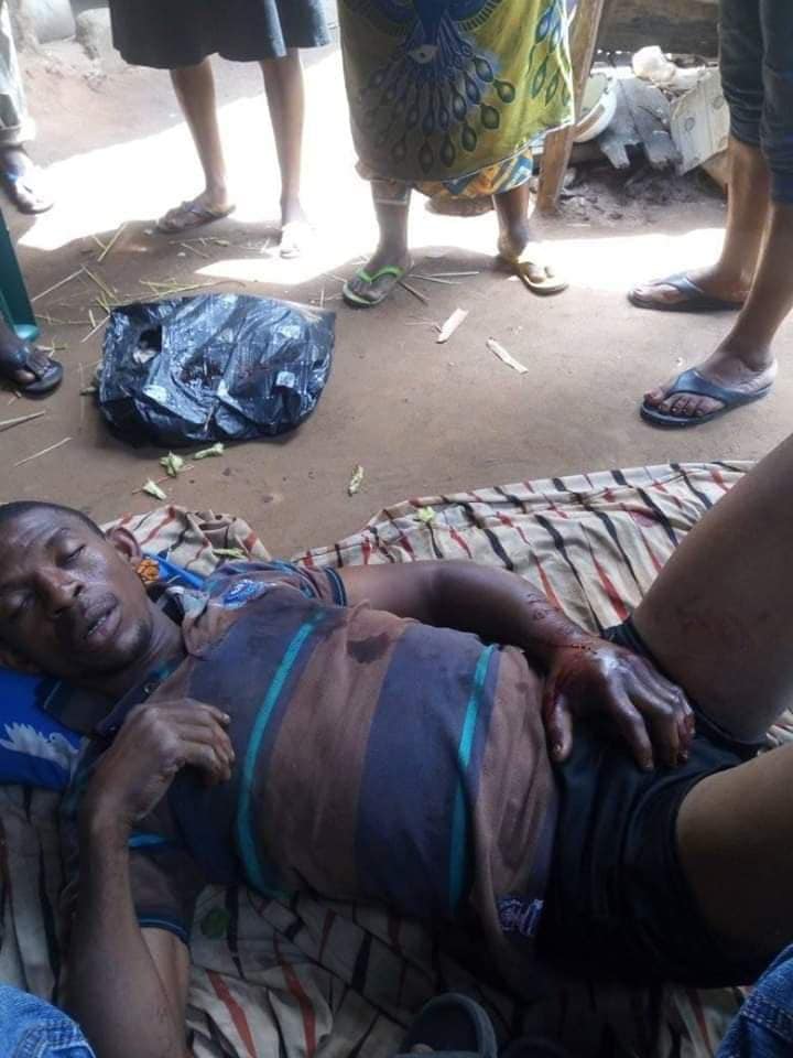 Man Dies Mysteriously After Snake Bite In Abia (Graphics Photos)