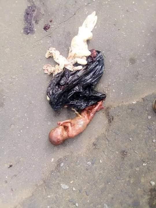 Lifeless Baby In Polythene Bag Discovered In Umuahia Street (Graphic Photos)