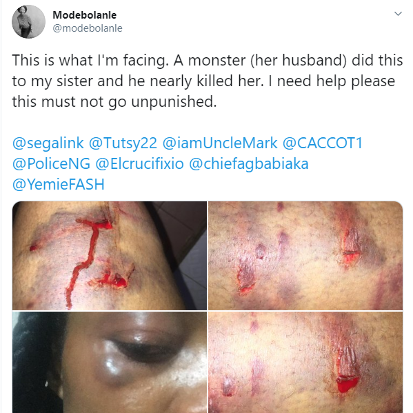 Nigerian lady shares horrific photos showing injuries inflicted on her sister by her husband as she calls for justice (photos)