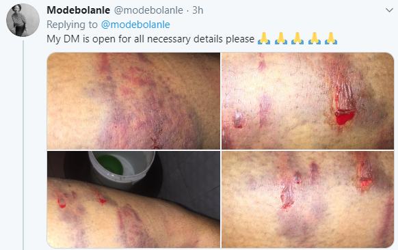 Nigerian lady shares horrific photos showing injuries inflicted on her sister by her husband as she calls for justice (photos)