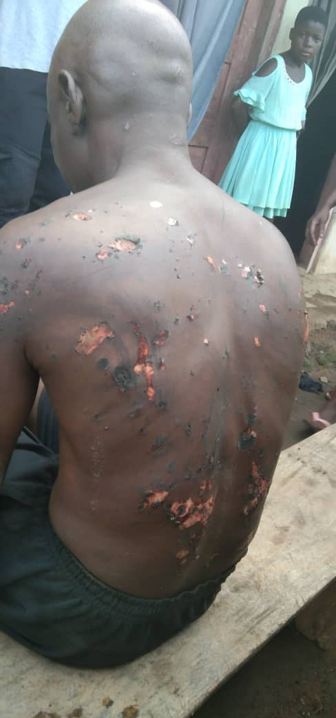 Special Adviser to the Cross River State Governor allegedly burns his subordinates after he had a dream that they betrayed him (photos)