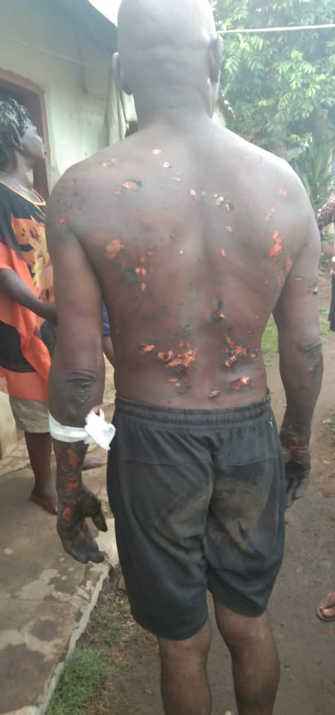 Special Adviser to the Cross River State Governor allegedly burns his subordinates after he had a dream that they betrayed him (photos)