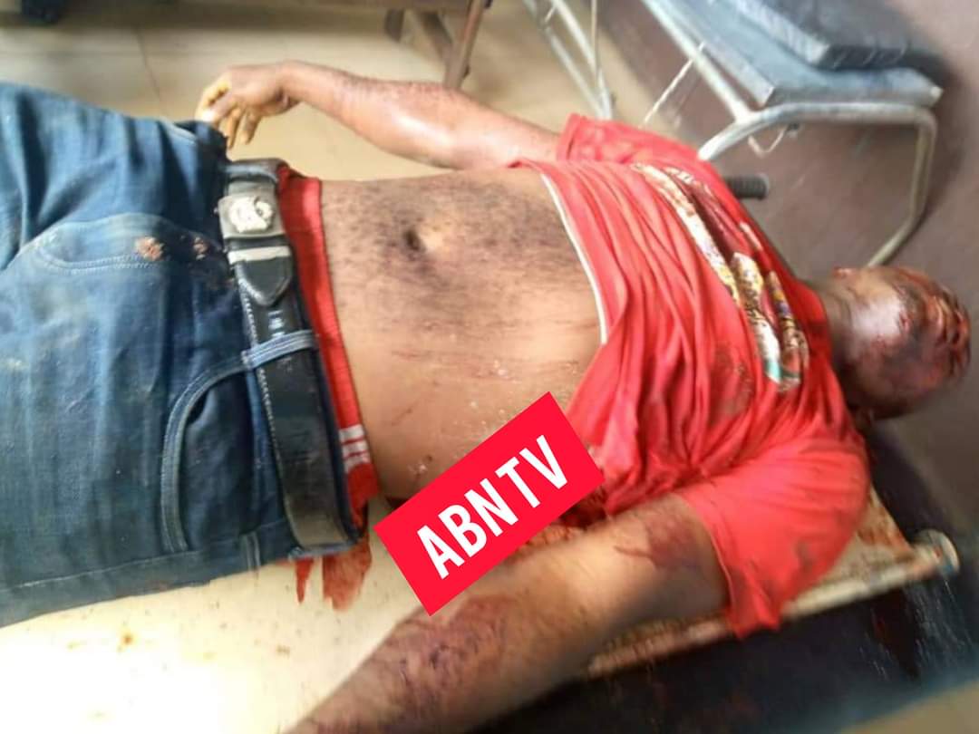 Anger As Road Safety Official Allegedly Stabs Bus Driver To Death In Abia (Graphic Photos)
