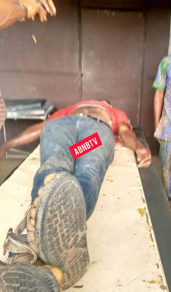 Anger As Road Safety Official Allegedly Stabs Bus Driver To Death In Abia (Graphic Photos)