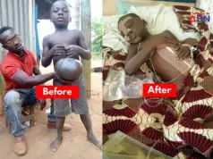 Dan Okeke Sponsors Umbilical Hernia Surgery Of 6-Year-Old Patient (Photos) Dan Okeke Sponsors Umbilical Hernia Surgery Of 6-Year-Old Patient (Photos)