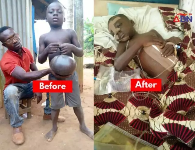 Dan Okeke Sponsors Umbilical Hernia Surgery Of 6-Year-Old Patient (Photos) Dan Okeke Sponsors Umbilical Hernia Surgery Of 6-Year-Old Patient (Photos)