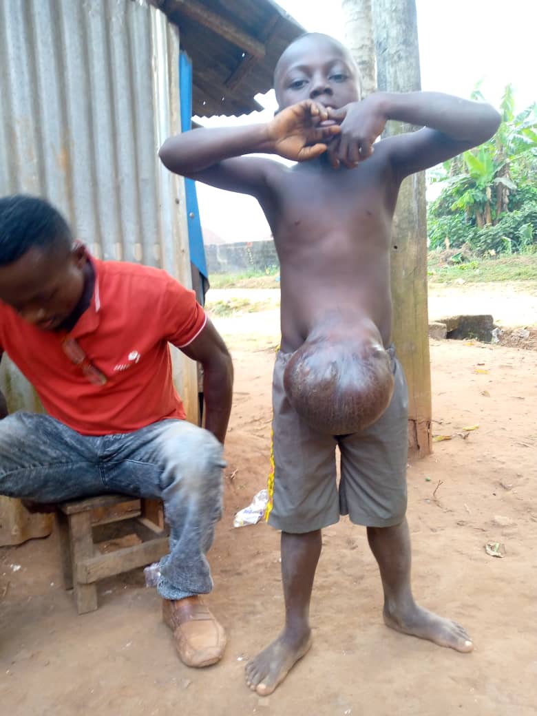 Dan Okeke Sponsors Umbilical Hernia Surgery Of 6-Year-Old Patient (Photos)