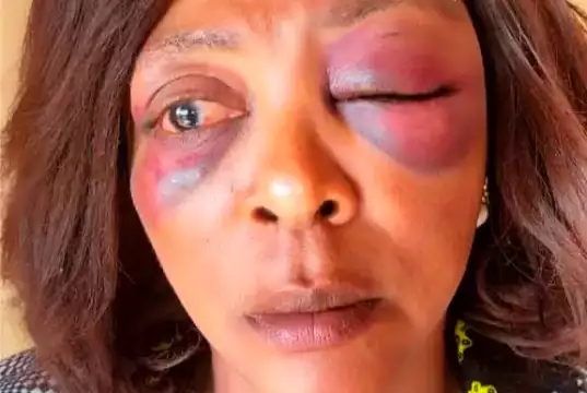 NSCDC Tenders Apology To Assault Victim, Vows To Carry Out Investigation