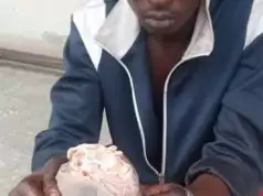 Jealous Lover Cuts Man’s Wrist In Nasarawa Over Girlfriend