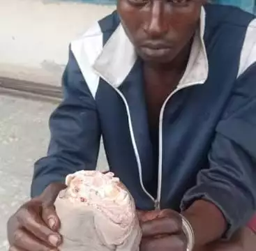 Jealous Lover Cuts Man’s Wrist In Nasarawa Over Girlfriend