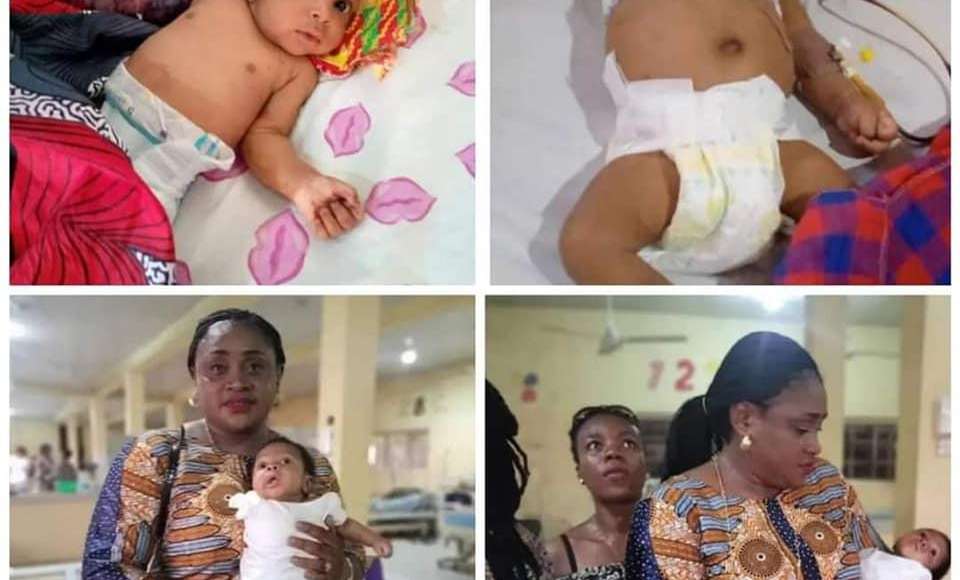 Angry As Father Beats 2-Months-Old Son With Hanger For Disturbing Him, Baby's Arm Amputated [DISTURBING PHOTOS]