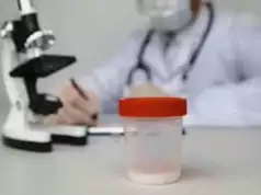 Low Sperm Count Curable – Fertility Experts Low Sperm Count Curable – Fertility Experts