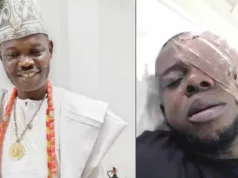 Trader Blinded By Ogun Traditional Ruler After He Allegedly Danced With Queen Demands Justice