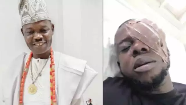 Trader Blinded By Ogun Traditional Ruler After He Allegedly Danced With Queen Demands Justice