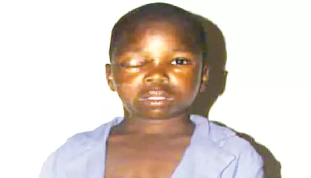 Hoodlums Remove 12-Year-Old Boy’s Eye In Bauchi