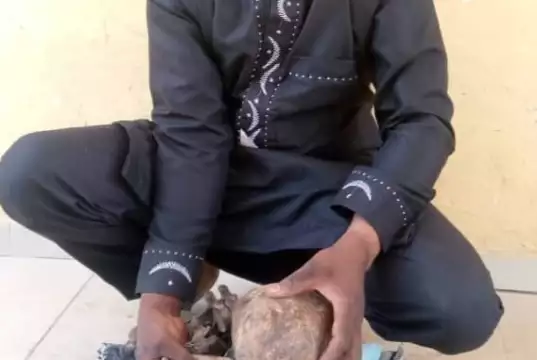 Benin Republic National Arrested With Human Skull, Others