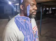 How Soldiers Assaulted House Of Representatives Member In Benue, Beat Him To Pulp