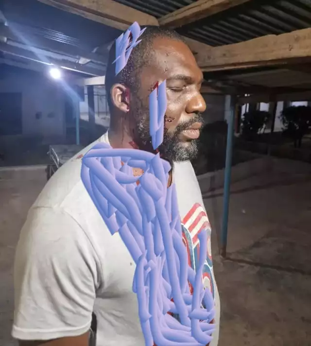 How Soldiers Assaulted House Of Representatives Member In Benue, Beat Him To Pulp