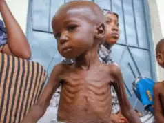 Nigeria Second Country With Worst Malnutrition – USAID Nigeria Second Country With Worst Malnutrition - USAID
