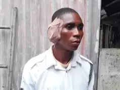 Drama As Driver Angrily Bites Off VIO Official’s Ear In Delta