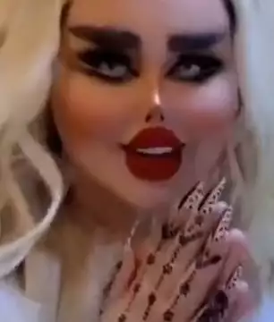 I’ve Had 43 Cosmetic Procedures To Become A Barbie Doll, Critics Say I Look Like A “Zombie” (PHOTOS, VIDEO) I've Had 43 Cosmetic Procedures To Become A Barbie Doll, Critics Say I Look Like A 'Zombie'