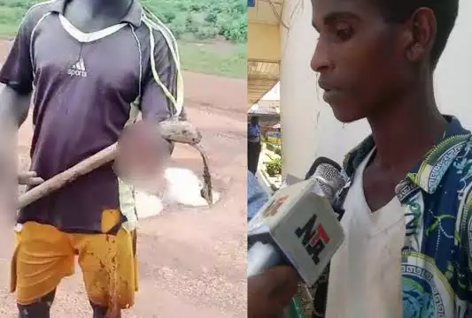 Herdsman Arrested For Cutting Off Farmer’s Hand In Plateau