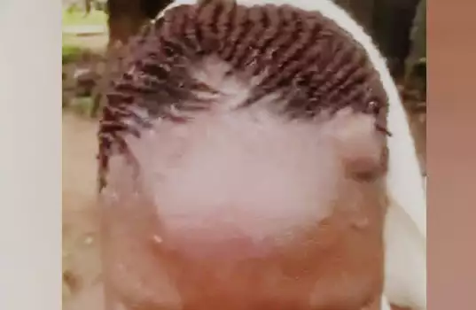 Ondo Commissioner Lands In Hospital After Attack Over Palliatives Distribution