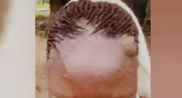 Ondo Commissioner Lands In Hospital After Attack Over Palliatives Distribution