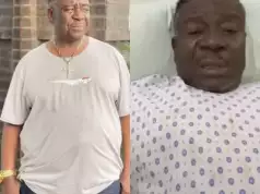 Doctors Amputate Mr Ibu’s Leg To Sustain His Life Doctors Amputate Mr Ibu’s Leg To Sustain His Life