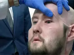 US Surgeons Successfully Perform World’s First Human Eye Transplant US Surgeons Successfully Perform World's First Human Eye Transplant