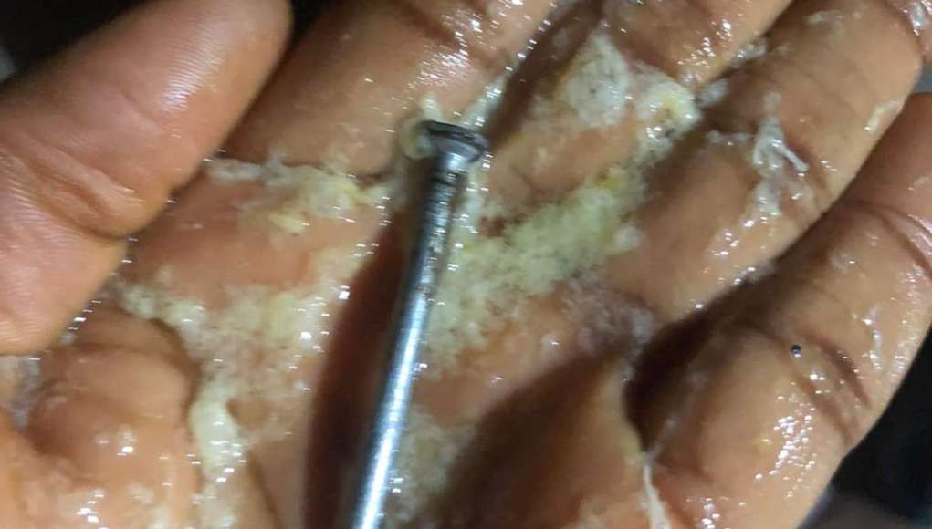 5-Month-Old Baby Vomits Swallowed Nail, Mother Expresses Gratitude (Photo)