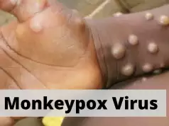Fears As Abia Confirms First Monkeypox Case Fears As Abia Confirms First Monkeypox Case