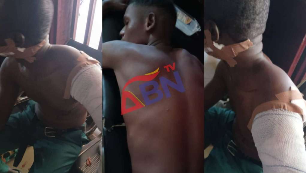 Armed Men With Keke Rob, Shot 2 PoS Operators In Umuahia (Photos, Video)