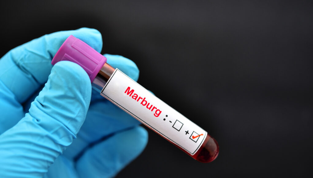 WHO Alerts On High-Risk Marburg Outbreak In Tanzania