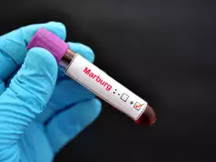 WHO Alerts On High-Risk Marburg Outbreak In Tanzania WHO Alerts On High-Risk Marburg Outbreak In Tanzania