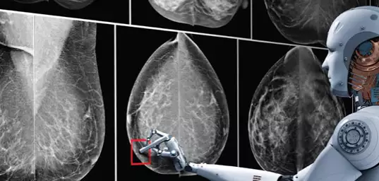 AI Set To Revolutionize Breast Cancer Detection For At-Risk Women AI Set To Revolutionize Breast Cancer Detection For At-Risk Women