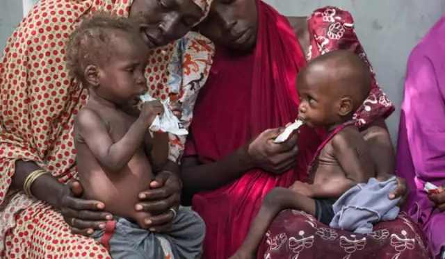 3.7 Million Northern Children Suffer Malnutrition, FAO Reports 3.7 Million Northern Children Suffer Malnutrition, FAO Reports