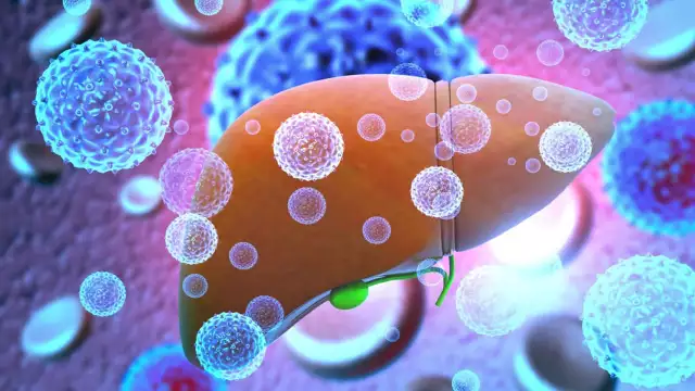 WHO Urges Swift Global Action To Curb Viral Hepatitis D WHO Urges Swift Global Action To Curb Viral Hepatitis D