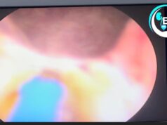 Hope For Men Battling Enlarged Prostate As New Laser Technology Arrives Nigeria Hope For Men Battling Enlarged Prostate As New Laser Technology Arrives Nigeria