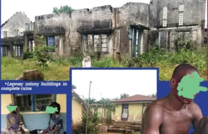 Neglected, Isolated: Untold Story Of Uzuakoli Leprosy Colony Inmates Neglected, Isolated: Untold Story Of Uzuakoli Leprosy Colony Inmates