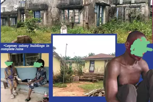 Neglected, Isolated: Untold Story Of Uzuakoli Leprosy Colony Inmates Neglected, Isolated: Untold Story Of Uzuakoli Leprosy Colony Inmates