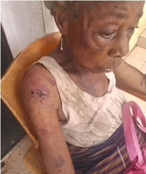 At 90, Abia Widow Fights For Life Amid Repeated Assault By Brother’s Wife, Kids At 90, Abia Widow Fights For Life Amid Repeated Assault By Brother’s Wife, Kids