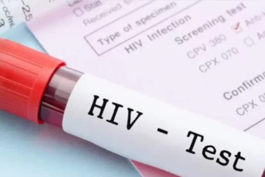 US Withdraws HIV Support For South Africa US Withdraws HIV Support For South Africa