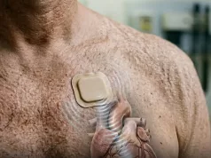 Heartbeat By Sound: Scientists Develop Non-Invasive Pacemaker Heartbeat By Sound: Scientists Develop Non-Invasive Pacemaker