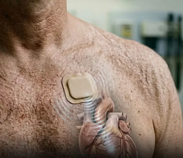 Heartbeat By Sound: Scientists Develop Non-Invasive Pacemaker