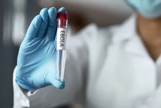 FG Identifies Ebola Disease’s Case In FCT, Begins Contact Tracing FG Identifies Ebola Disease's Case In FCT, Begins Contact Tracing