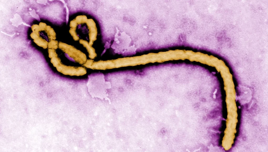 Ebola_virus_purple-1536x864 WHO Begins Ebola Vaccine Trial In DR Congo