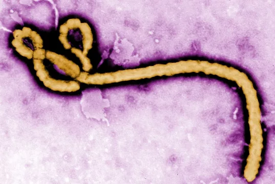 WHO Begins Ebola Vaccine Trial In DR Congo WHO Begins Ebola Vaccine Trial In DR Congo